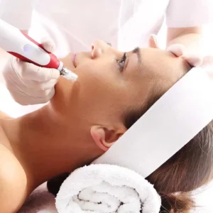 Rejuvapen Micro-needling. Course of 3