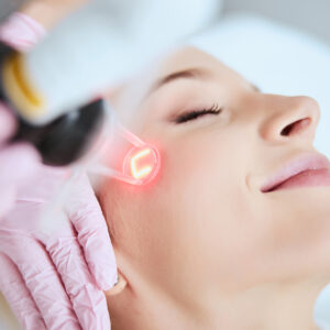 Secret PRO RF Micro-needling. Course of 3